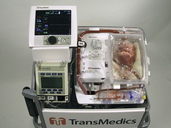 悉尼圣文森特医院的医生运用澳大利亚开发的心脏复跳控制台和保存液为患者移植死了的心脏。